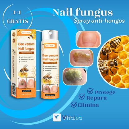 AntiHongos Spray🧫NailFungus™| 1+1 GRATIS