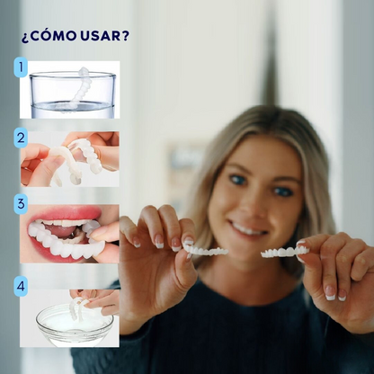 SmileFit™ - Carillas Ajustables para tu Sonrisa Radiante