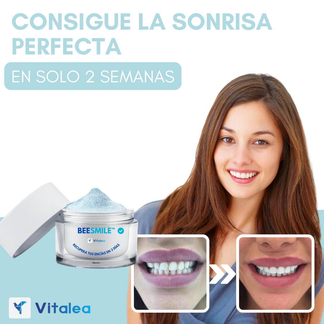 💥 BeeSmile™ - Recupera tus encías y transforma tu sonrisa. 💥