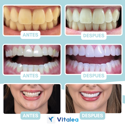 💥 BeeSmile™ - Recupera tus encías y transforma tu sonrisa. 💥