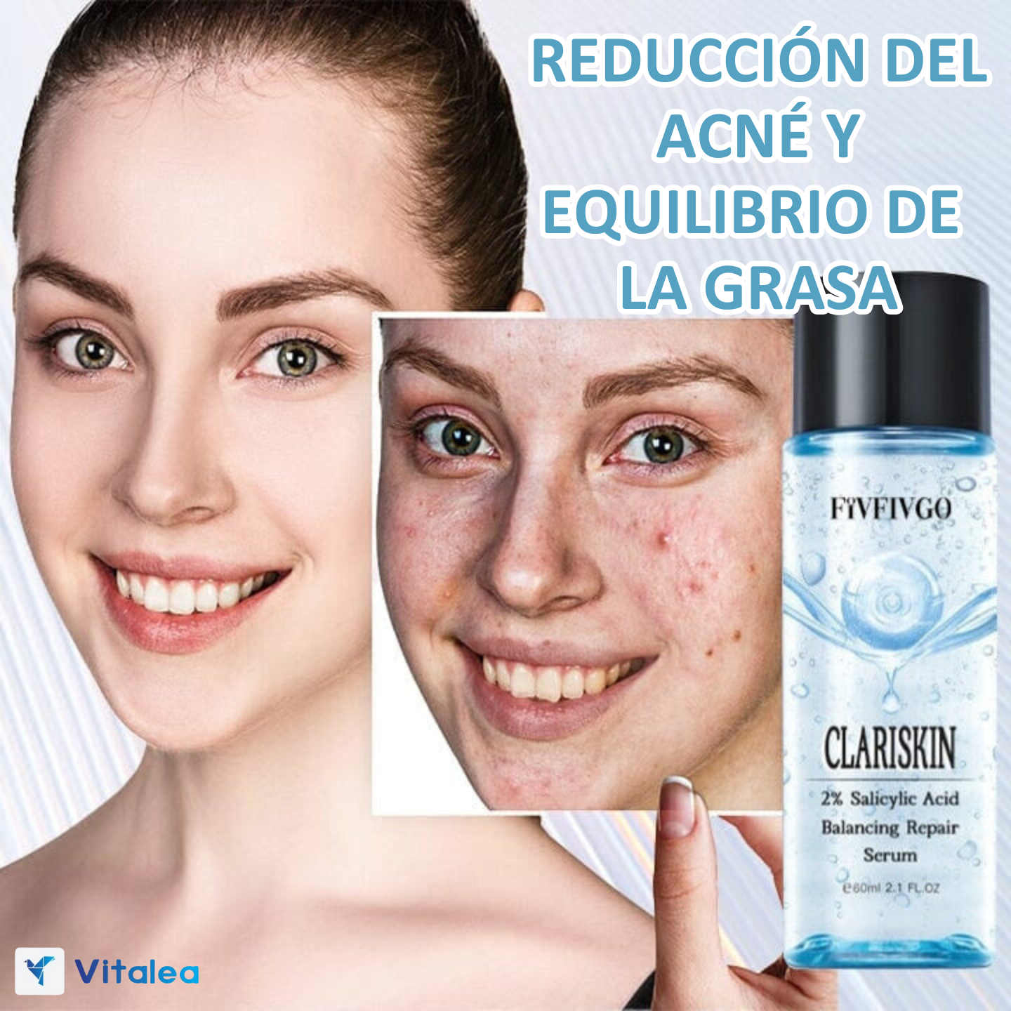 🌟ClariSkin™ - Suero reparador anti-acné🌟