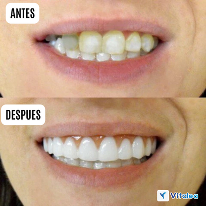 😁🦷Prótesis universales (talla única, se adapta a la boca)🦷😁