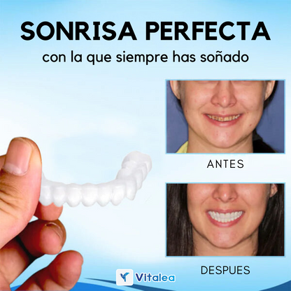 Dentaduras postizas ajustables a presión Fivfivgo™ 🔥 OFERTA DEL ÚLTIMO DÍA