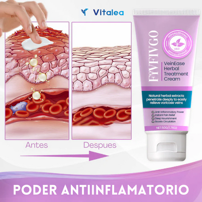 🦵🏻VeinEase™ - 🧴Crema natural de hierbas para varices🦵🏻