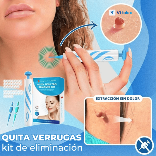 Quita Verruga Vitalea: Kit de eliminación de verrugas natural