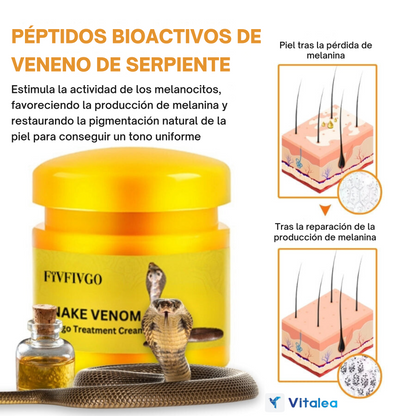 🧴SnakeCare™ Crema para el tratamiento del vitíligo con veneno de serpiente🐍