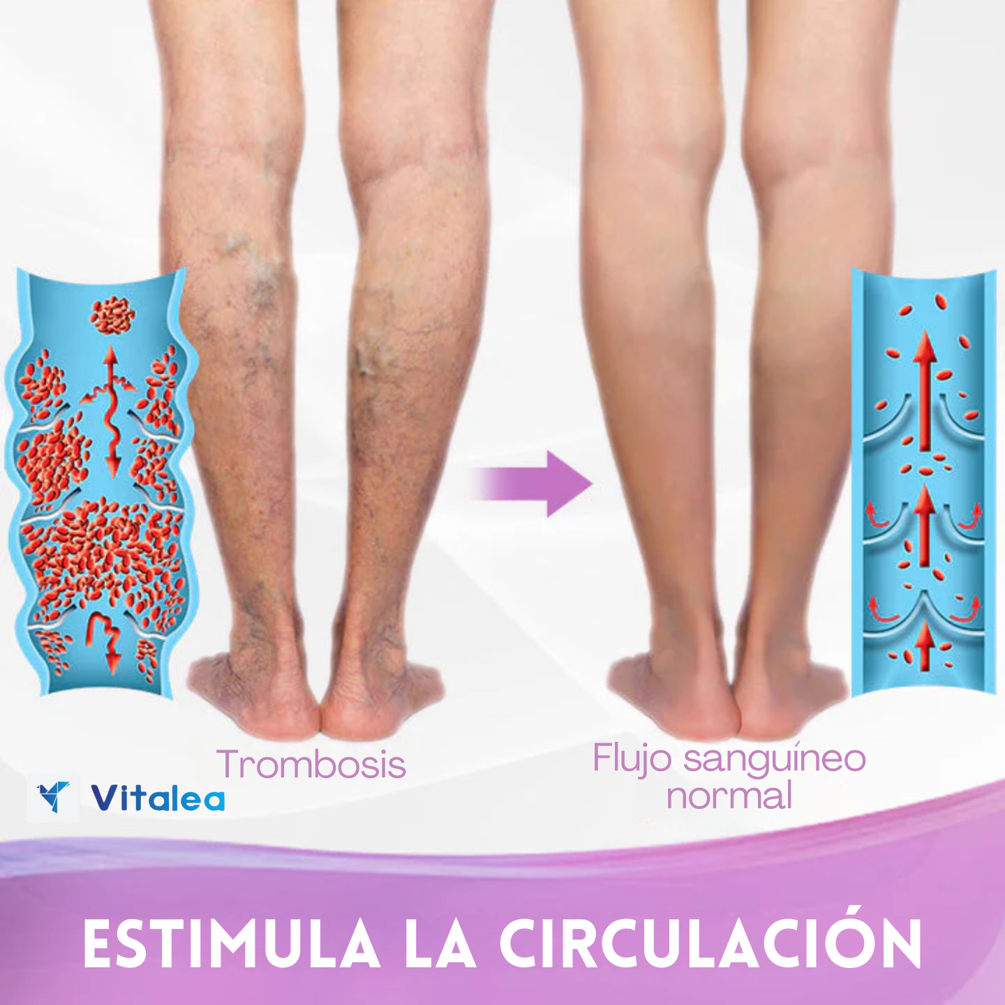 🦵🏻VeinEase™ - 🧴Crema natural de hierbas para varices🦵🏻