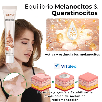 🧴DermaGlow™ Crema para el tratamiento del vitíligo con escualeno🧴