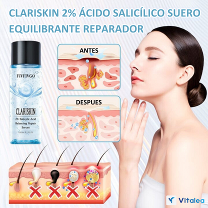 🌟ClariSkin™ - Suero reparador anti-acné🌟