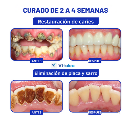 💥 BeeSmile™ - Recupera tus encías y transforma tu sonrisa. 💥