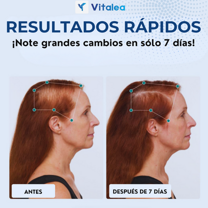 HairGenix - Regenerador capilar