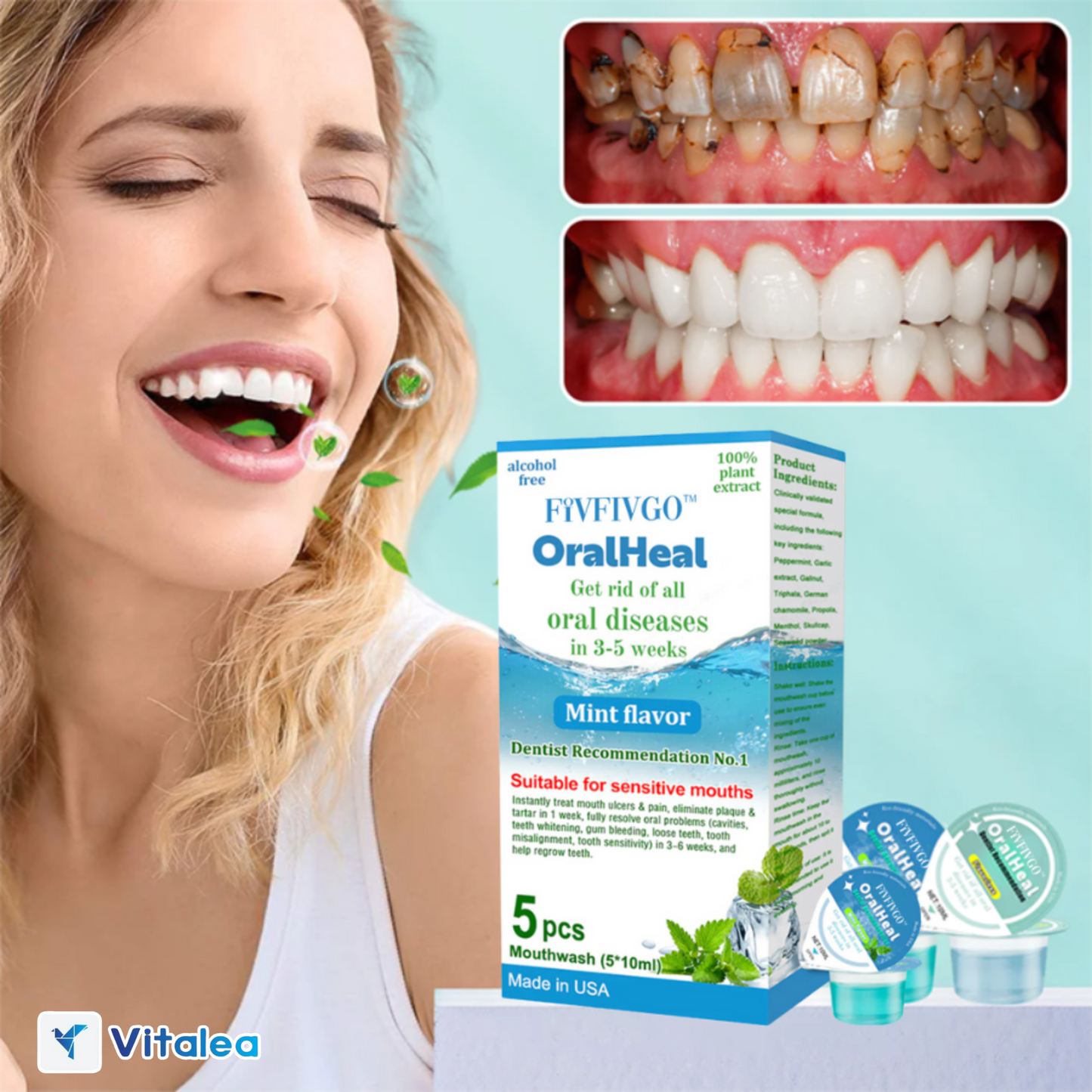 🌬️OralHeal - Enjuage bucal para la eliminación de sarro🌬️