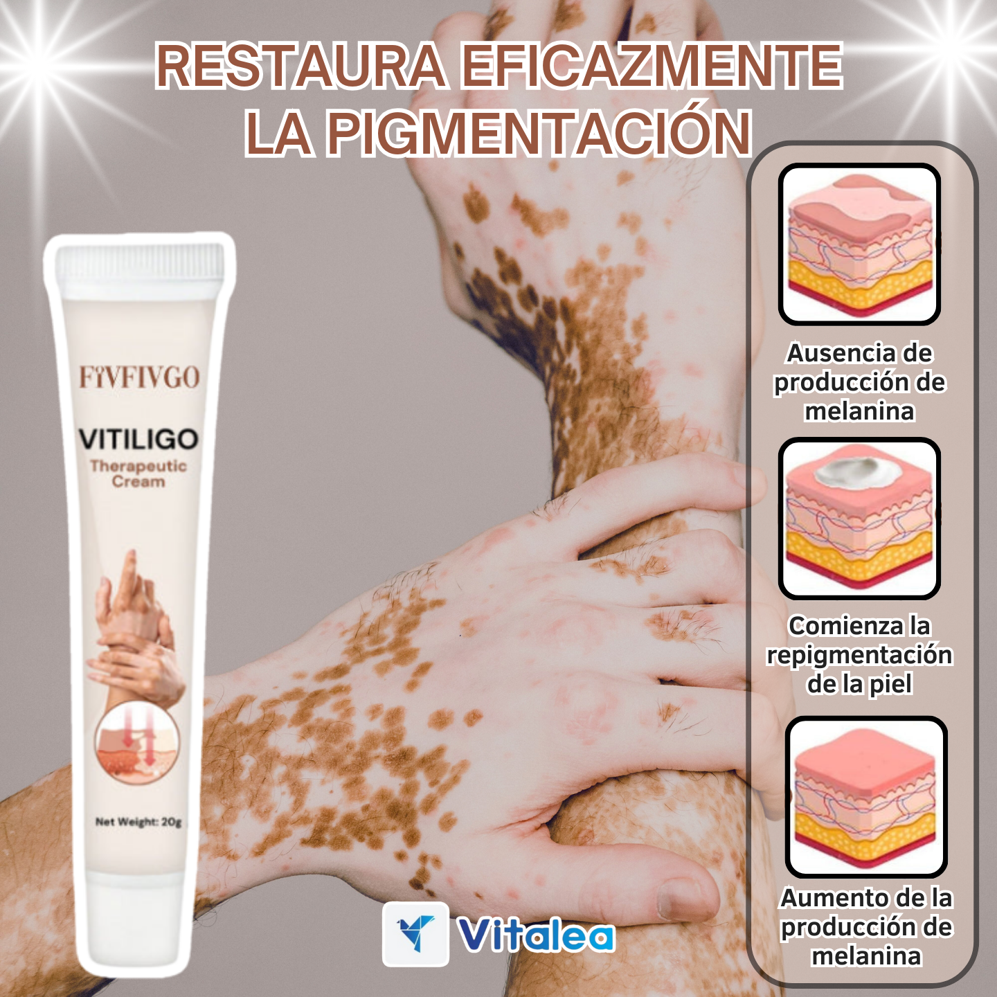 ✨🧴 VitaColor  - Crema terapeútica para el Vitíligo🧴✨