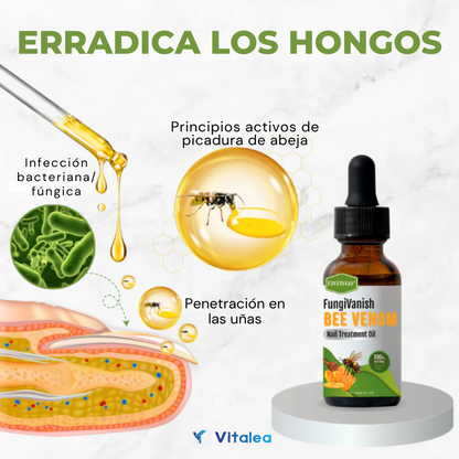 🛡️💅🏻Aceite para tratamiento de uñas con veneno de abeja Fivfivgo™ FungiVanish💅🏻🛡️