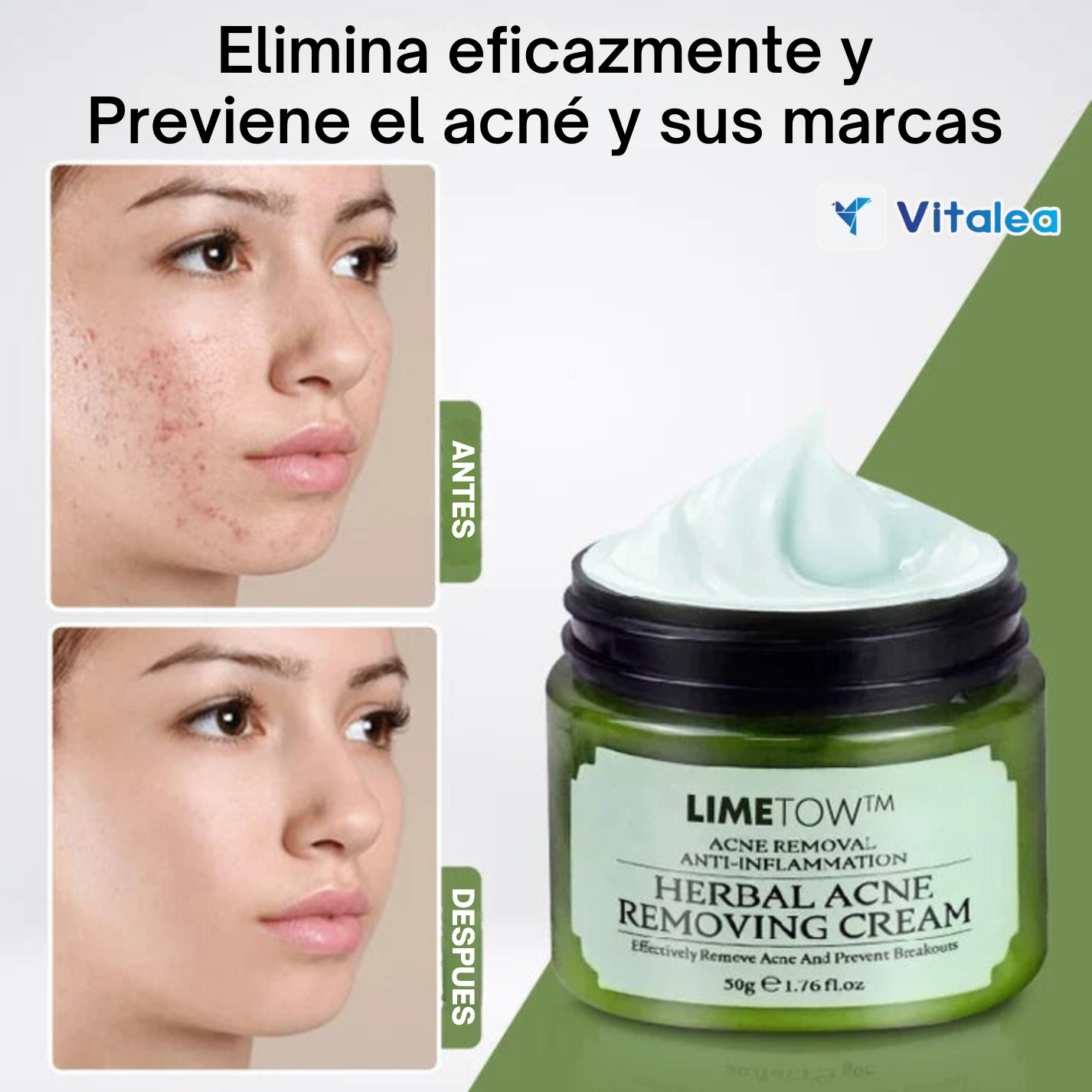 🧴💫LimeTow -  1 + 1 Gratis crema de hierbas para eliminar el acné💫🧴