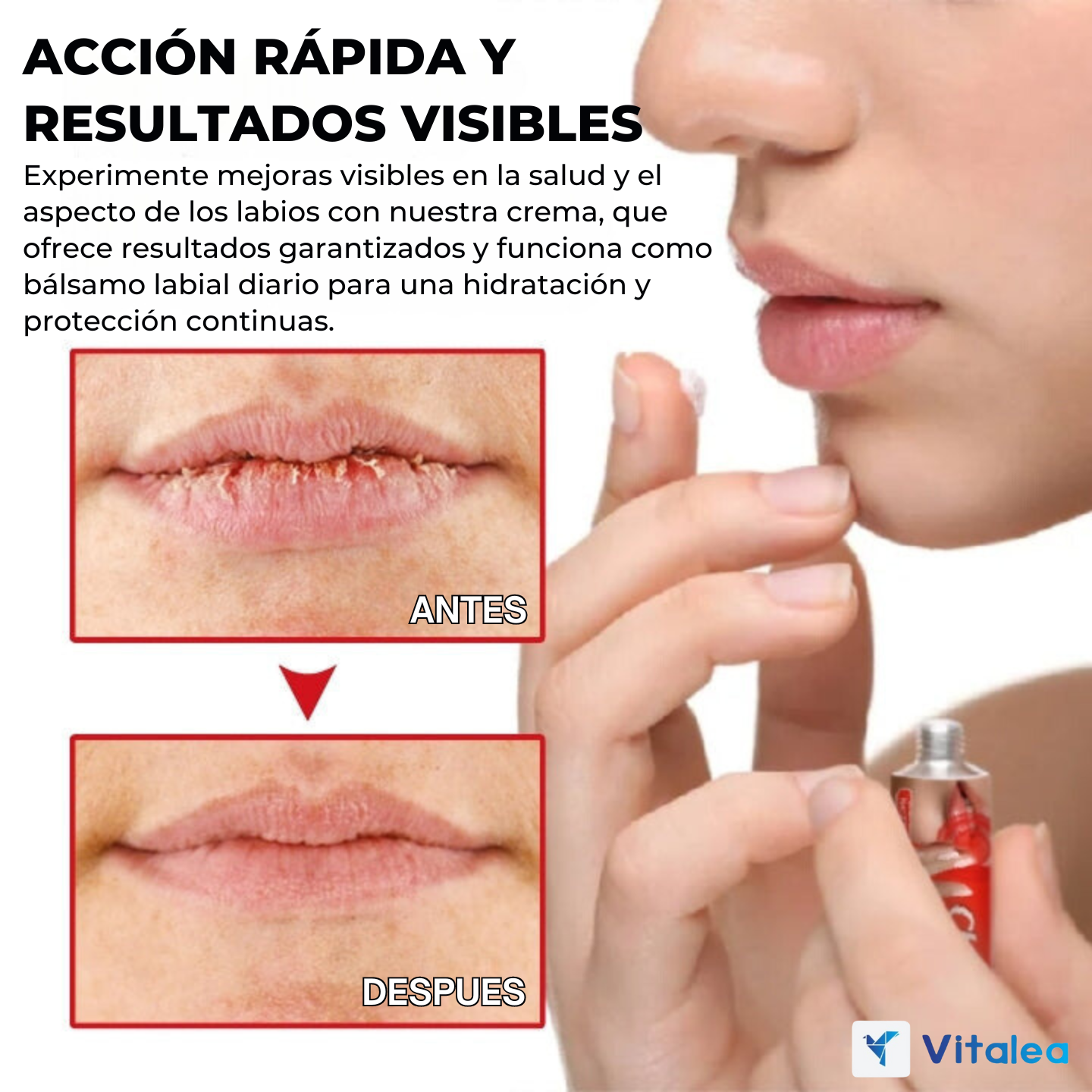 👄Cheilitis™ - Crema para labios perfectvos al instante👄