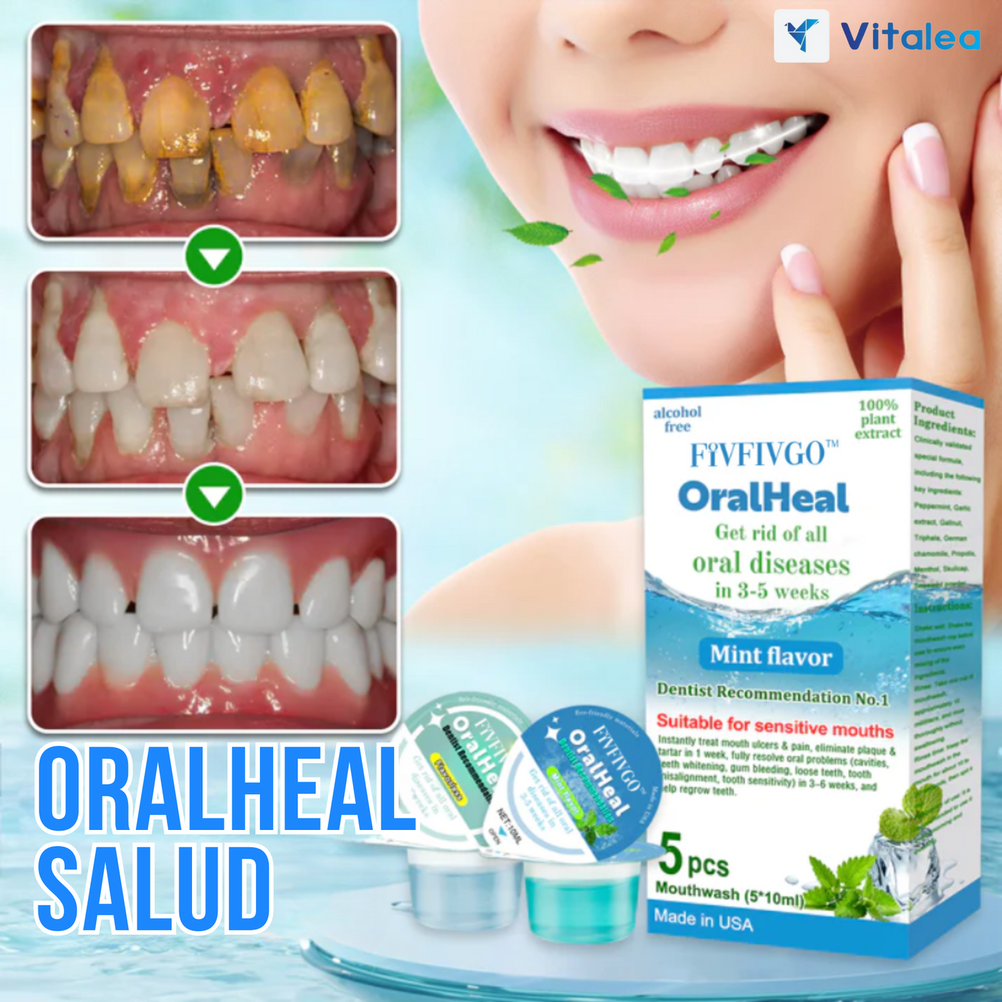 🌬️OralHeal - Enjuage bucal para la eliminación de sarro🌬️