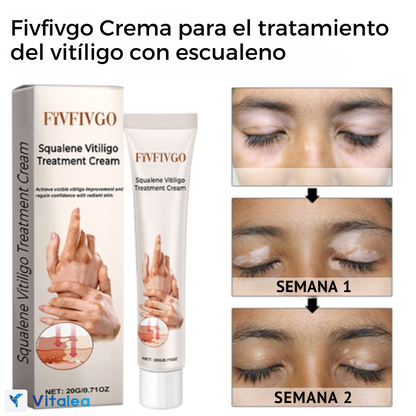 🧴DermaGlow™ Crema para el tratamiento del vitíligo con escualeno🧴