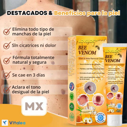 🚫Magic Cream™: Crema para quitar verrugas con Veneno de Abeja🐝