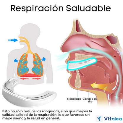 😴WellSleep™ - Dispositivo bucal para un sueño de calidad😴 | 1+1 GRATIS
