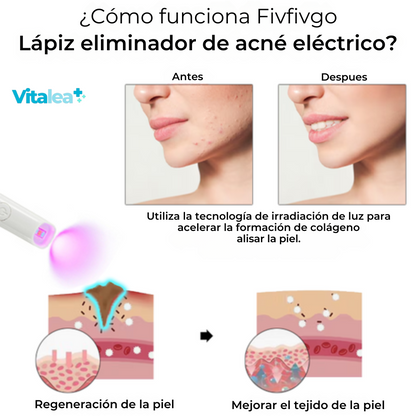 Lápiz eliminador de acné eléctrico Fivfivgo™🫧🧴✨