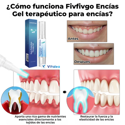 Fivfivgo™ gel🧫 terapéutico de protección de las encías