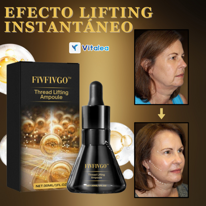 ✨ Ilumina, reafirma y transforma con LumiLift.™✨