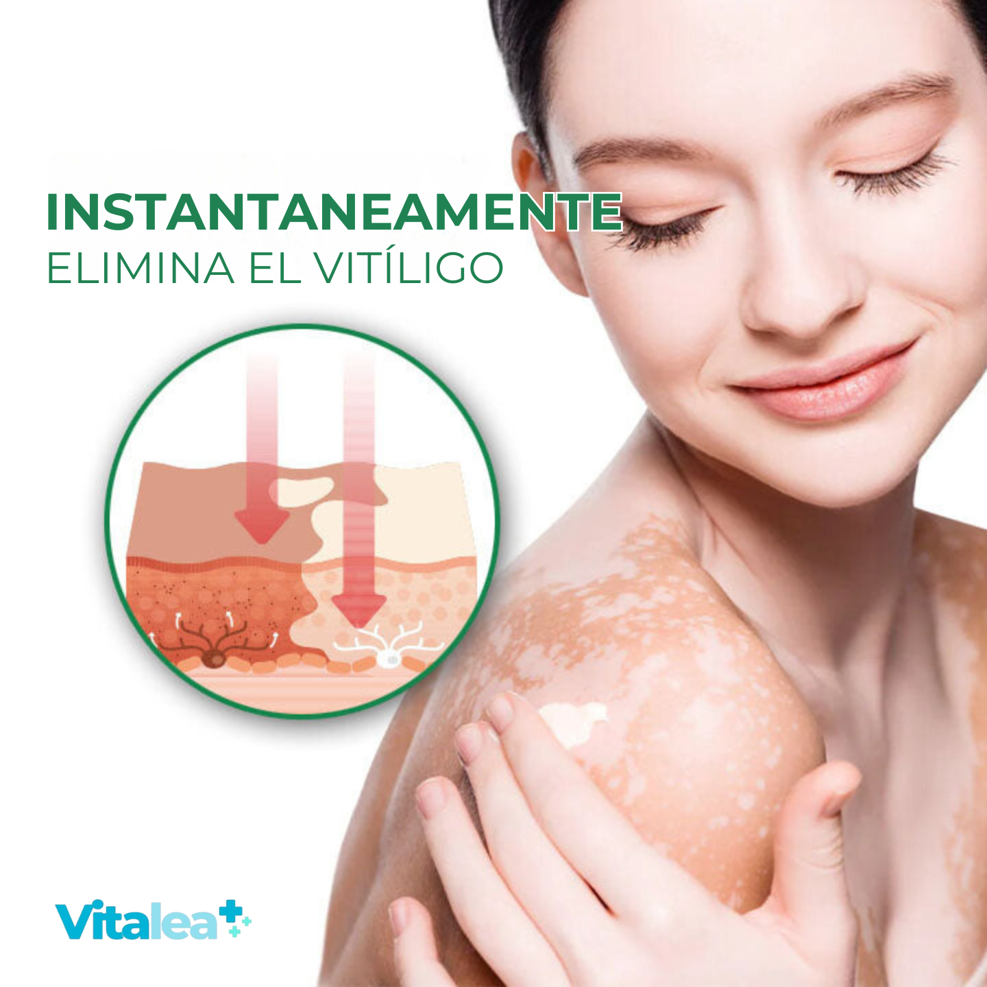 🌿Elixir revitalizante para el vitíligo Fivfivgo™🌿