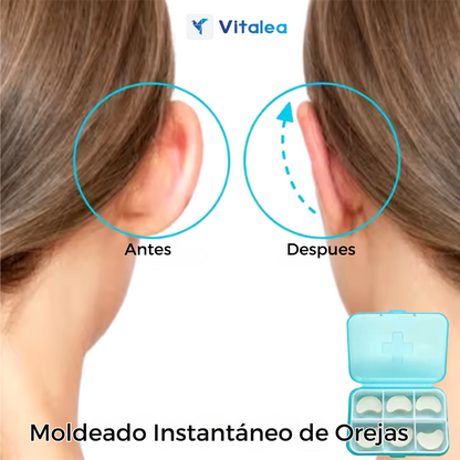 👂🏻corrector de orejas fitvftigo👂🏻