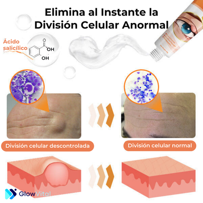 GlowVital FivFivGO™ - Gel eliminador de bultos y marcas