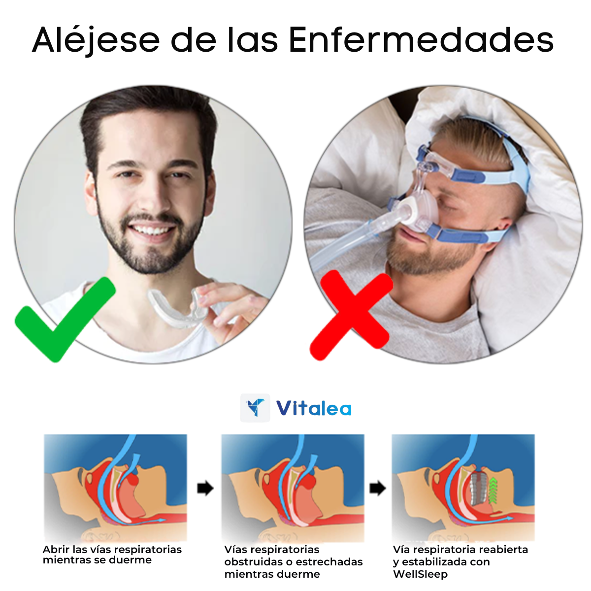 😴WellSleep™ - Dispositivo bucal para un sueño de calidad😴 | 1+1 GRATIS