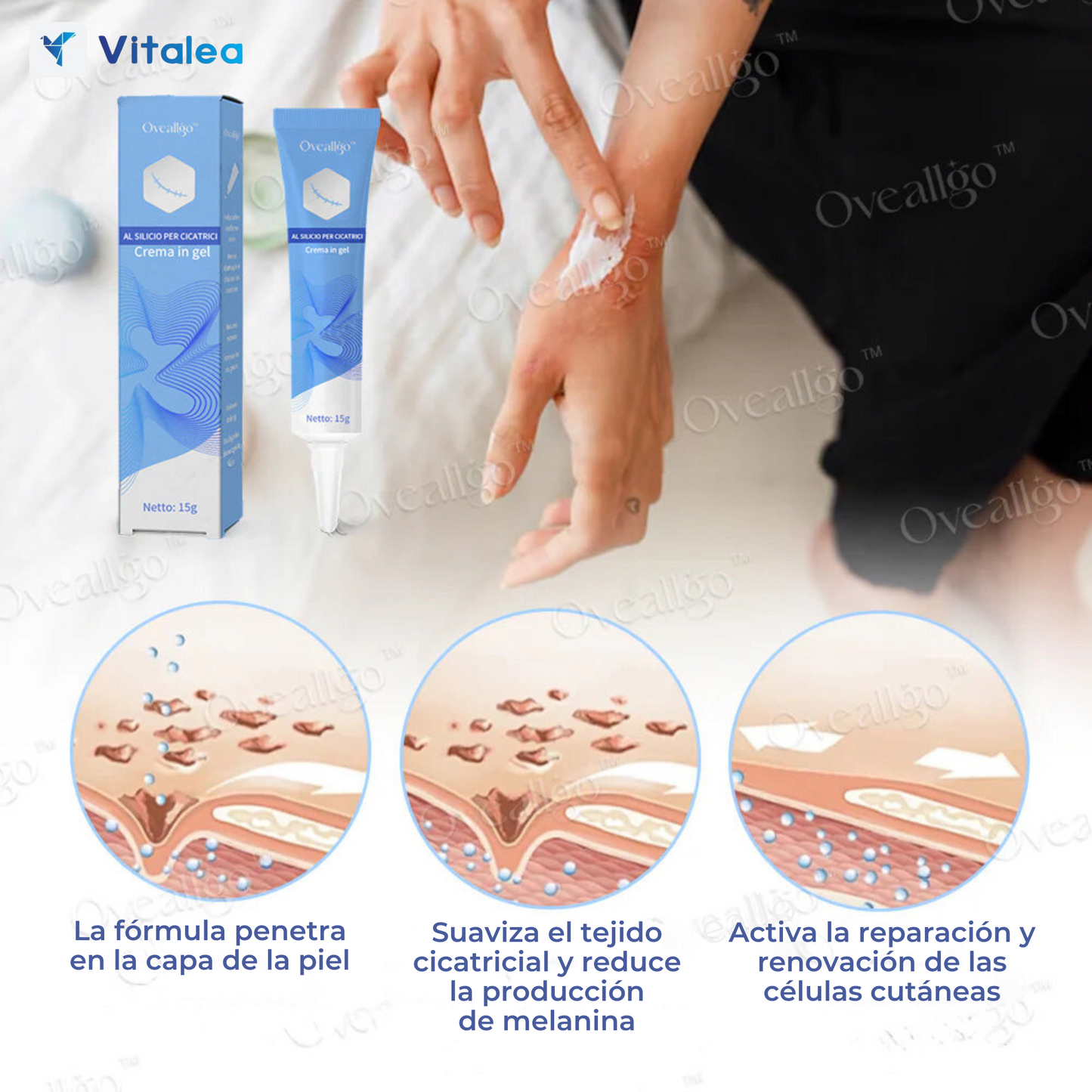 💫Oveallgo™ Crema Antiescaras de Sílice - ¡Disfruta de una piel clara y radiante!💫