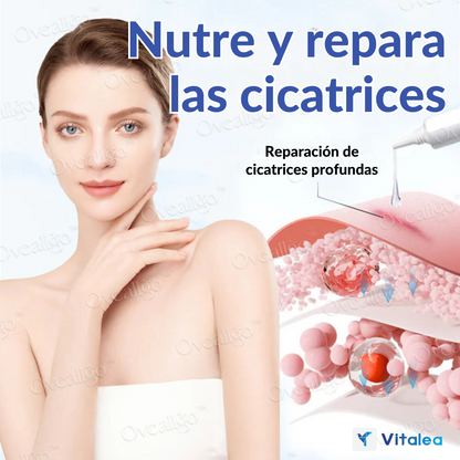 💫Oveallgo™ Crema Antiescaras de Sílice - ¡Disfruta de una piel clara y radiante!💫