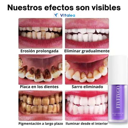 💜Fivfivgo™ Espuma blanqueadora de dientes puramente vegetal