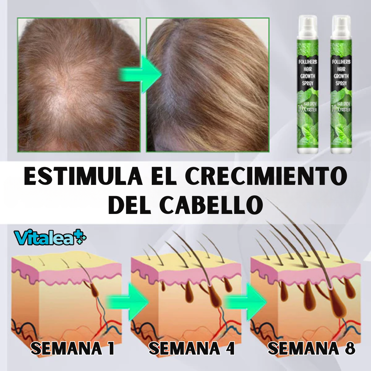 Fivfivgo™ ⛫💨Spray para el crecimiento del cabello FolliHerb