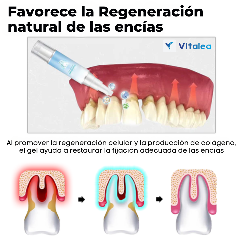 Fivfivgo™ gel🧫 terapéutico de protección de las encías