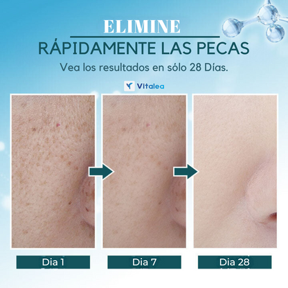 Seurico: crema para eliminar manchas de la cara