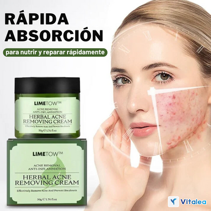 🧴💫LimeTow -  1 + 1 Gratis crema de hierbas para eliminar el acné💫🧴