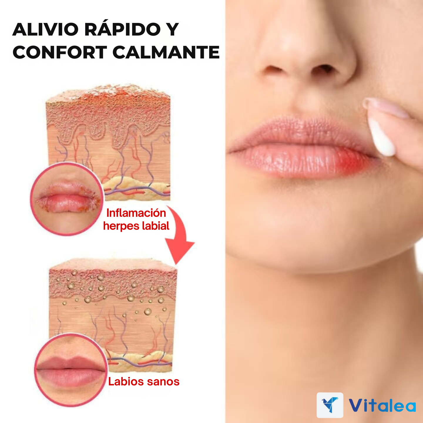 👄Cheilitis™ - Crema para labios perfectvos al instante👄