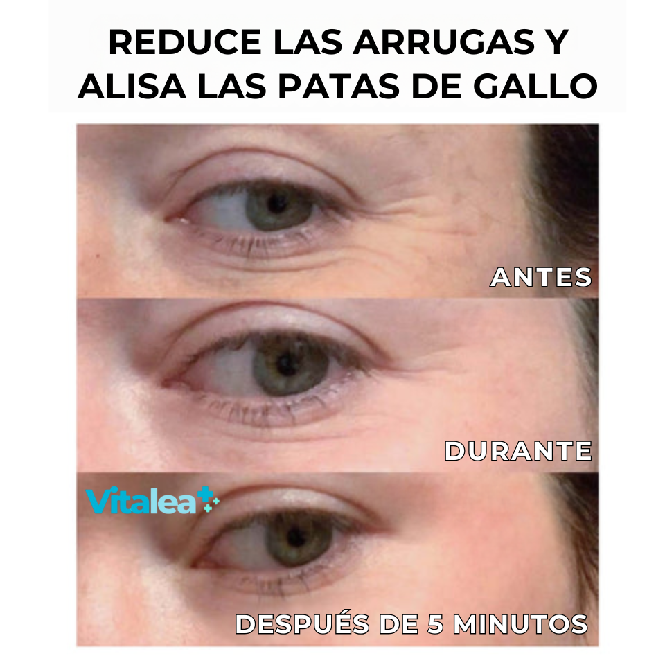 Fivfivgo™ Clinical SkinCare Reafirmante de ojos instantáneo✨