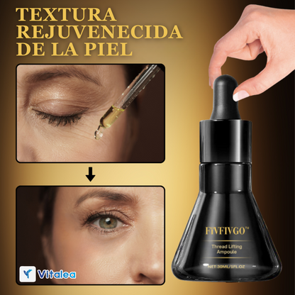 ✨ Ilumina, reafirma y transforma con LumiLift.™✨