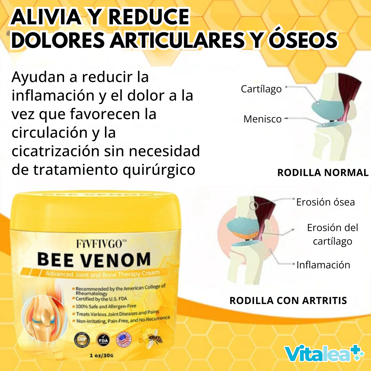 Crema para huesos y articulaciones con veneno de abeja Fivfivgo™ (extracto de abeja de Nueva Zelanda; se especializa en enfermedades ortopédicas y dolor de artritis)🐝