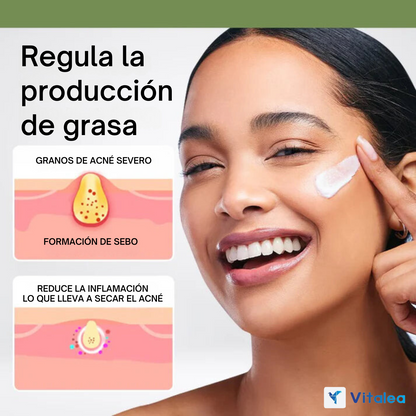 🧴💫LimeTow -  1 + 1 Gratis crema de hierbas para eliminar el acné💫🧴