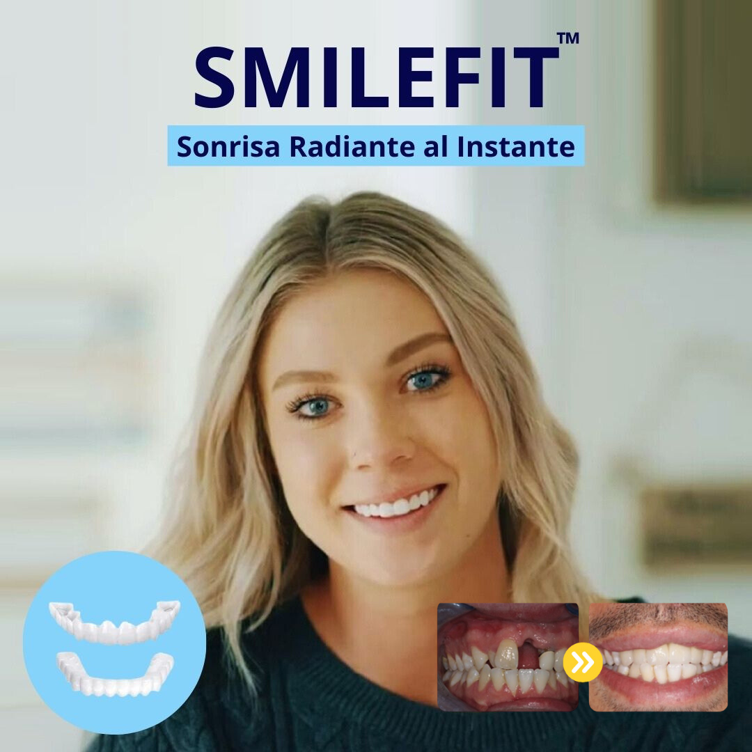 SmileFit™ - Carillas Ajustables para tu Sonrisa Radiante