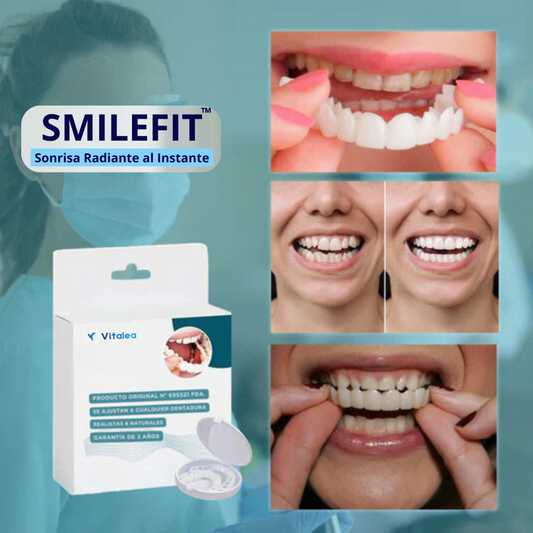 SmileFit™ - Carillas Ajustables para tu Sonrisa Radiante