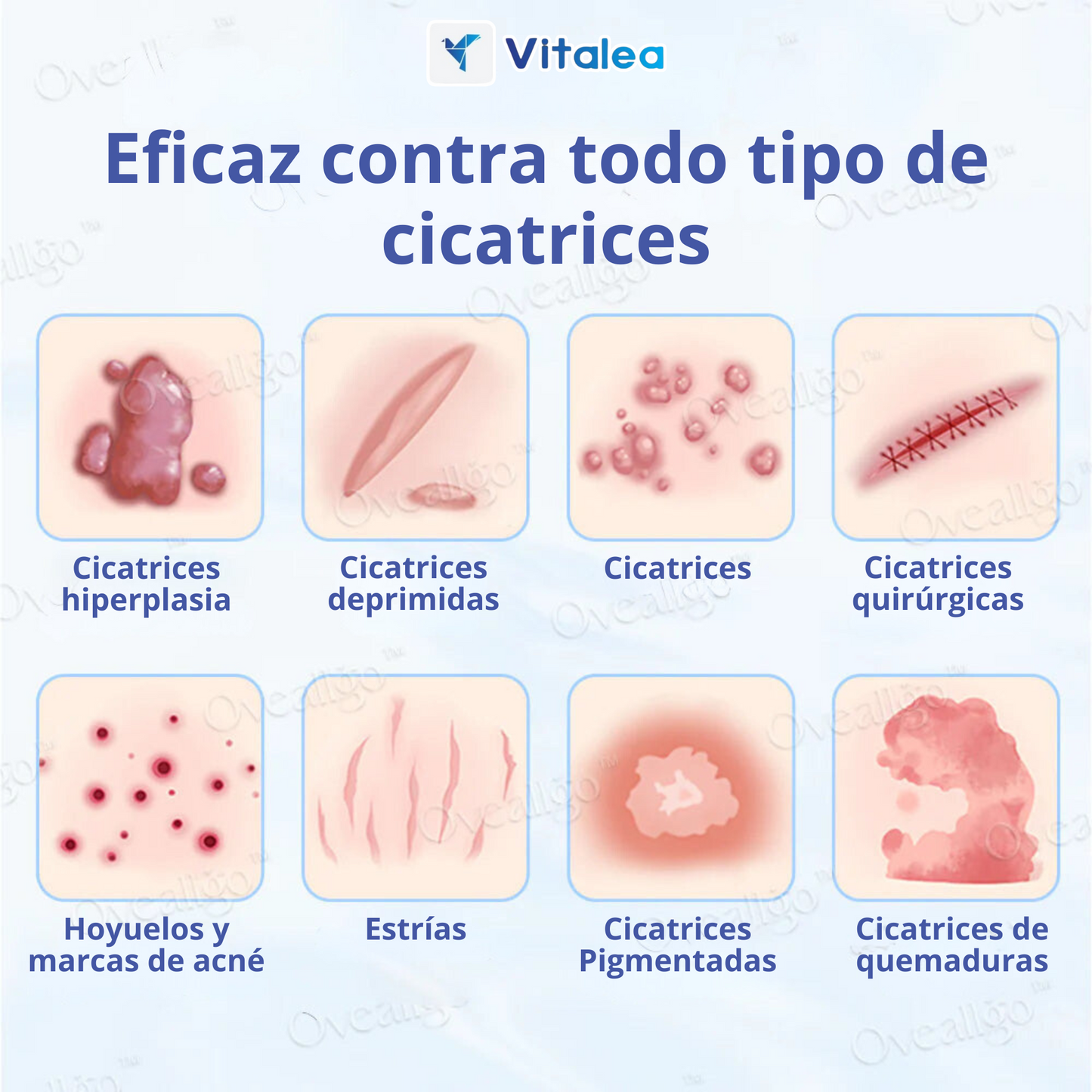 💫Oveallgo™ Crema Antiescaras de Sílice - ¡Disfruta de una piel clara y radiante!💫