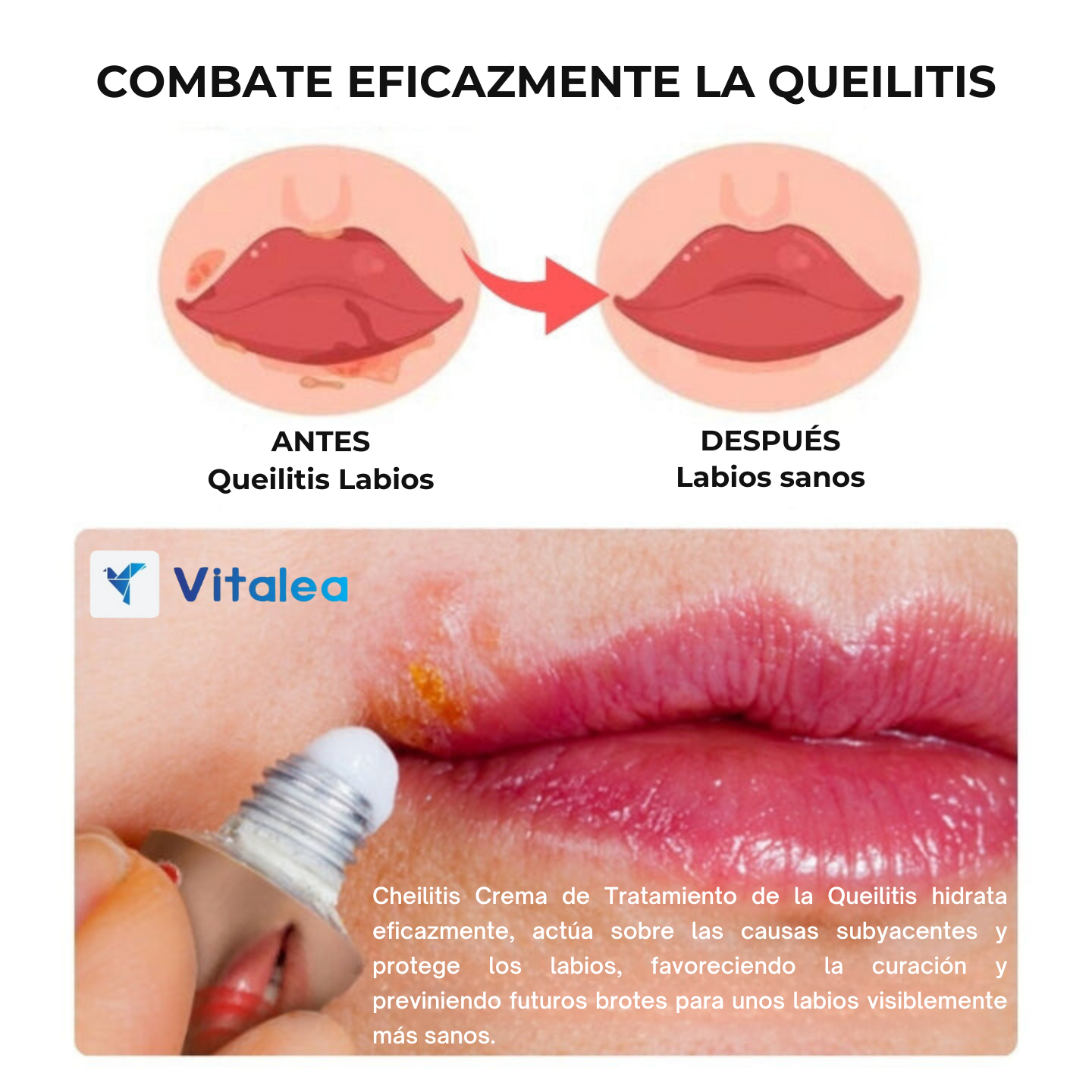 👄Cheilitis™ - Crema para labios perfectvos al instante👄