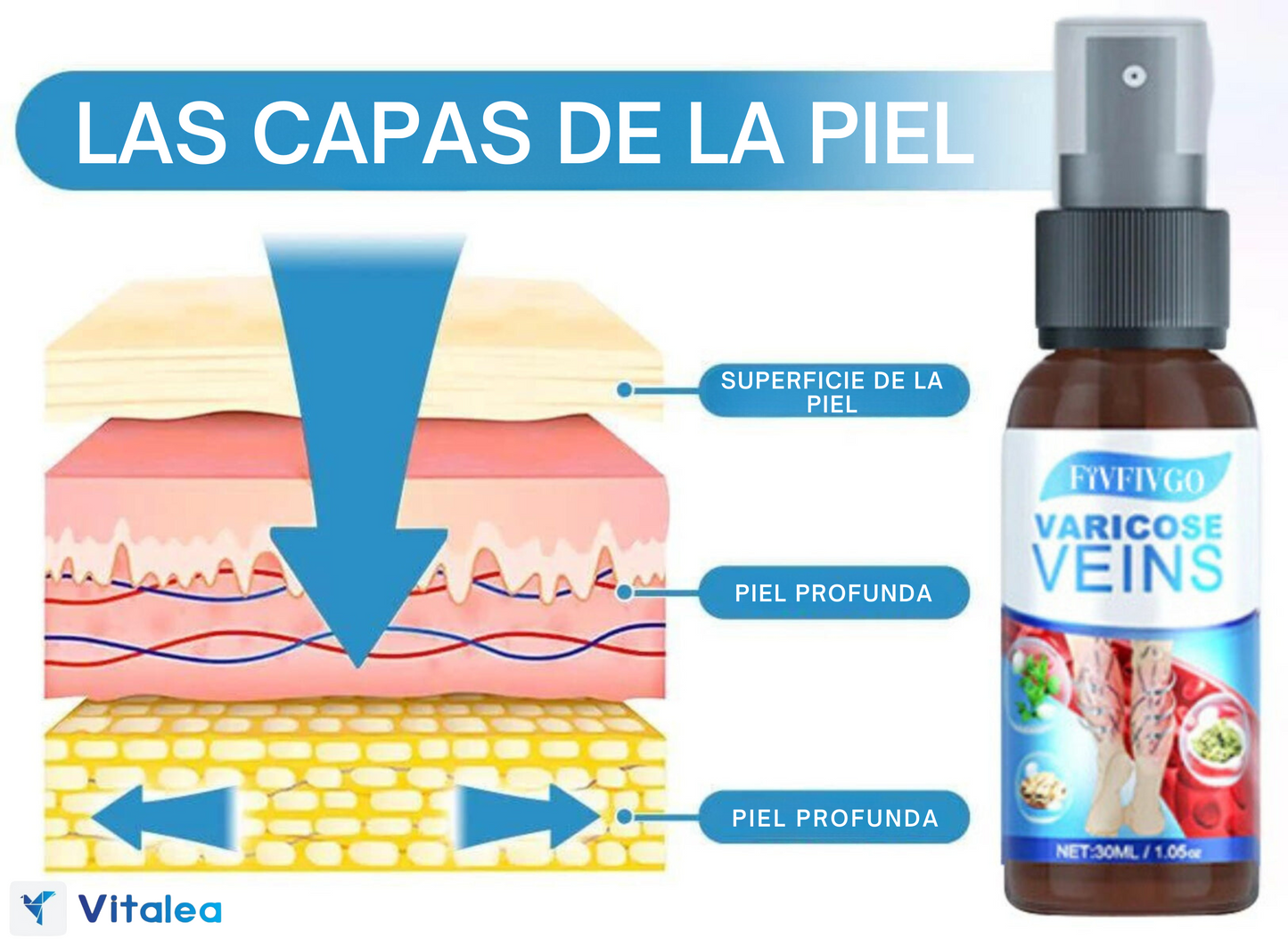 VarixEase™™ Spray para venas varicosas 1 + 1 GRATIS