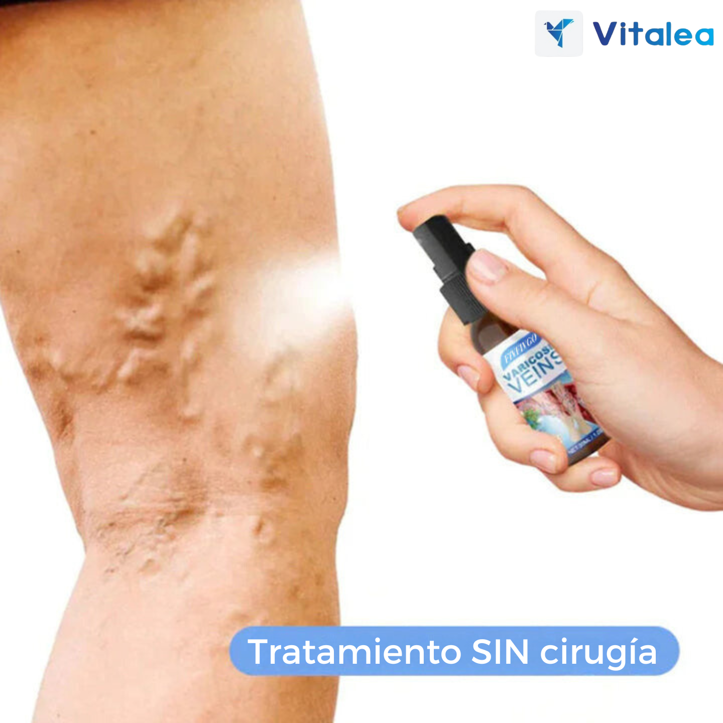 VarixEase™™ Spray para venas varicosas 1 + 1 GRATIS