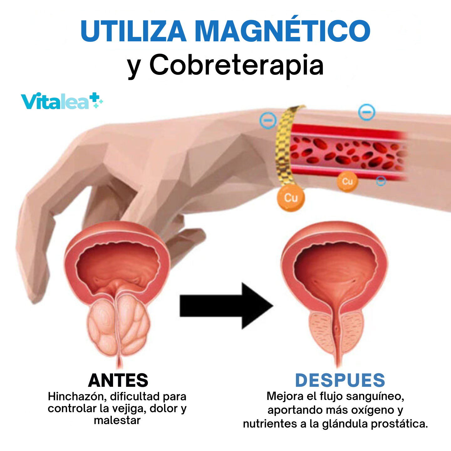 Fivfivgo™ Banda magnética de cobre para la próstata🧲